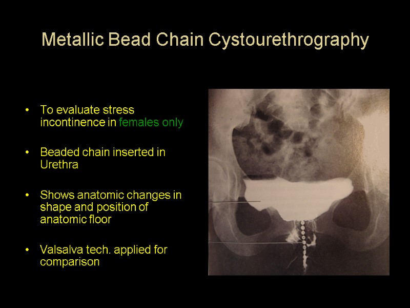 Metallic Bead Chain Cystourethrography   To evaluate stress incontinence in females only 